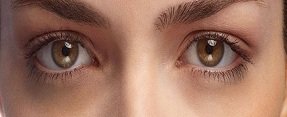 get rid of dark circles at home